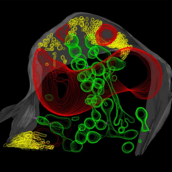 Scan of plant roots and their symbiotic fungi