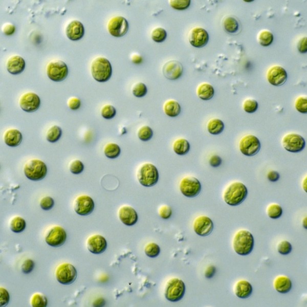 microscopic view of algae
