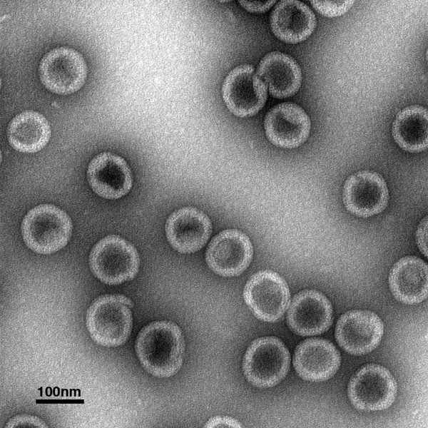 HIV-1 protein structure stained and viewed under an electron microscope