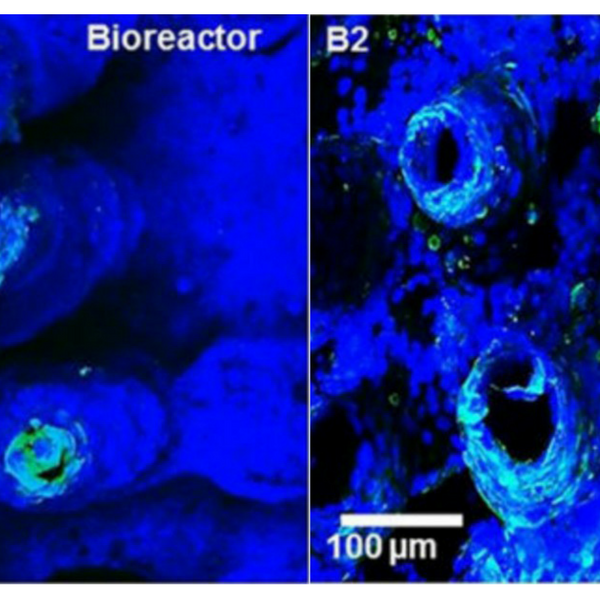 Screenshot of microscopic intestinal villi