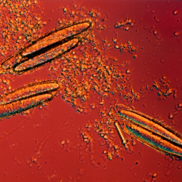 Epulopiscium sp. cells under microscope