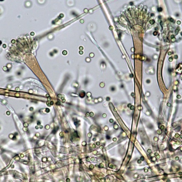 Microscopic view of mold