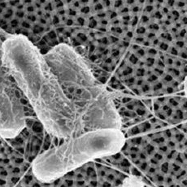 Microscopic view of bacteria