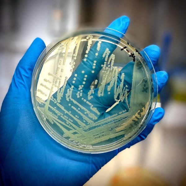 A gloved hand holds up an agar plate teeming with Salmonella cells