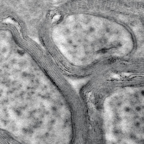 black and white swirls