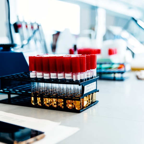 Test tubes on a lab bench 