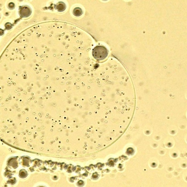 a microscopic image of microcleaner collecting plastic microparticles as it self-propels in water