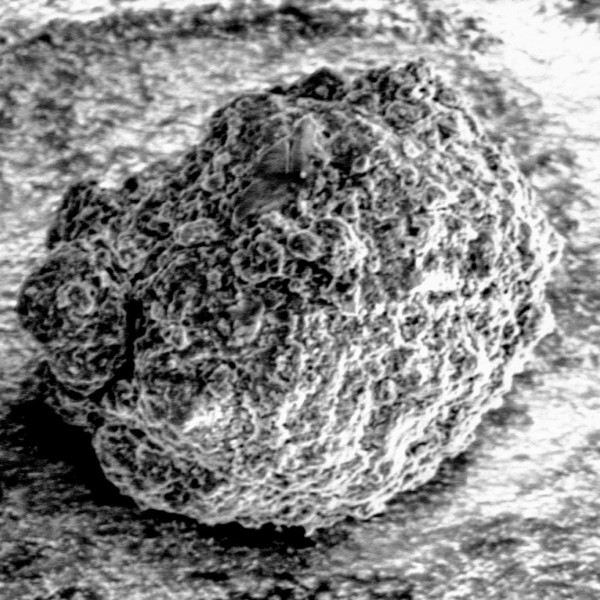 A black and white microscope image of soil