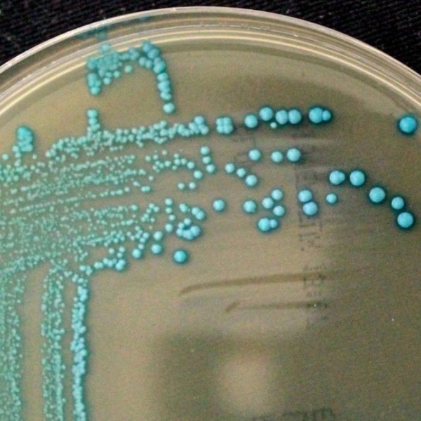 Blue-looking listeria cossartiae on a petri dish