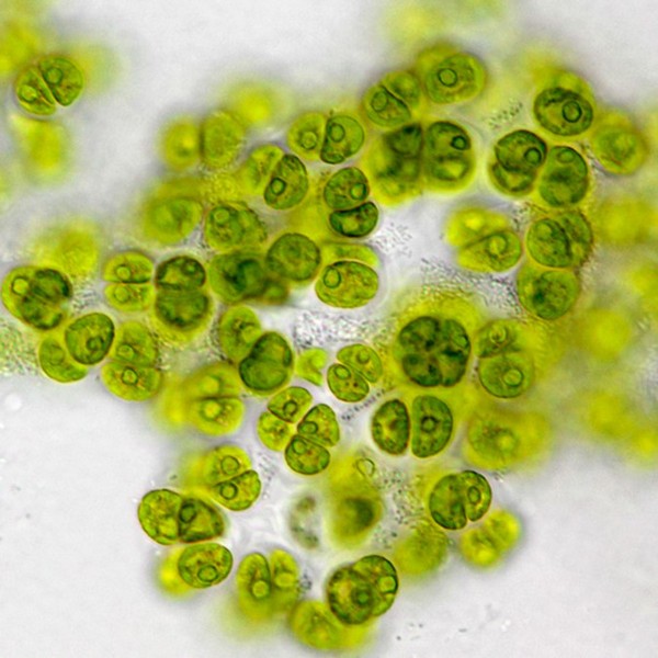Green alga under a microscope 