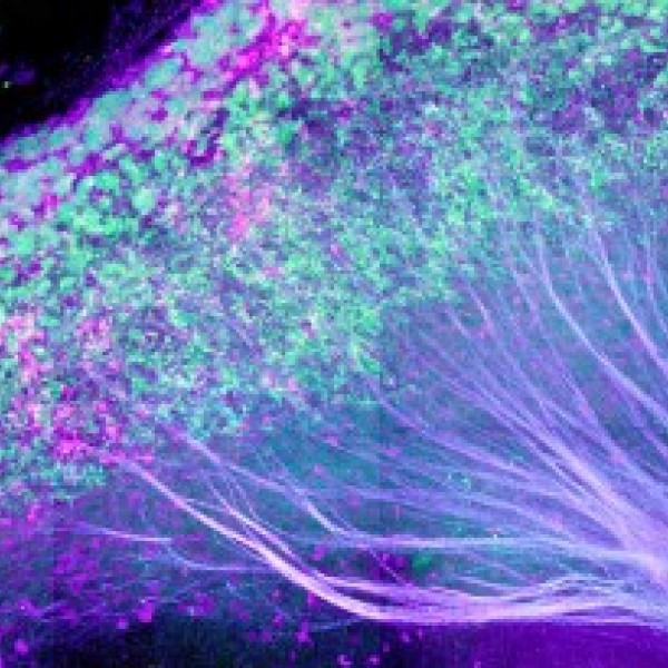 The lateral habenula in the mouse brain, with axons streaming down to dopaminergic and serotonergic centers.