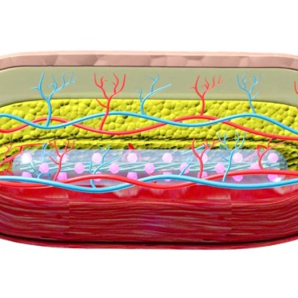 Diagram of a skin layer with an implant placed between the skin and muscle.
