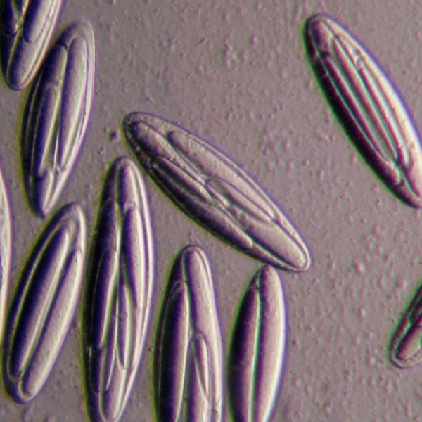 Oval bacteria under a microscope.